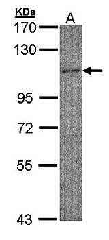 Western Blot analysis of A:Hela S3 whole cell lysate using MYBPC2 antibody 