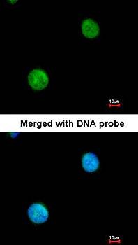  Confocal immunofluorescence analysis of paraformaldehyde-fixed HeLa using MYBPC2 antibody