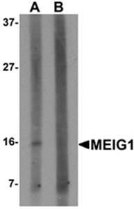 Western blot analysis of human kidney tissue lysate at 1 ug/mL in (A) the absence and (B) the presence of blocking peptide using MEIG1 antibody