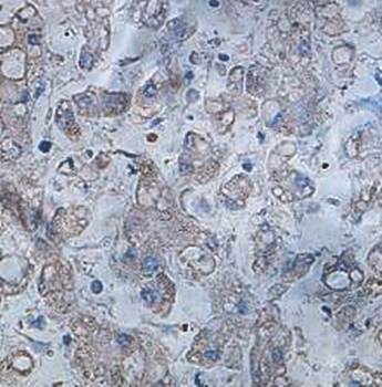Immunohistochemical analysis of formalin-fixed paraffin embedded fetal liver showing cytoplasmic staining using IWS1 antibody 