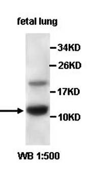 Western blot analysis of fetal lung lysate using ACYP2 antibody 