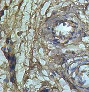  Immunohistochemical analysis of formalin-fixed paraffin embedded fetal stomach showing cytoplasmic staining using ACYP2 antibody