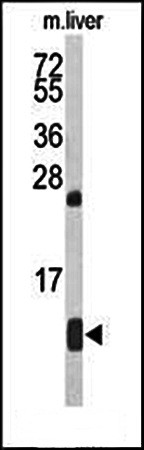  Western blot analysis of HBA2 antibody in mouse liver tissue lysates 