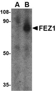 Western blot analysis of SK-N-SH cell lysate at 1 ug/mL in the (A) presence and (B) absence of blocking peptide using FEZ1 antibody