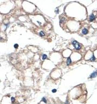 Immunohistochemical analysis of formalin-fixed paraffin embedded fetal liver showing membrane staining using ABHD3 antibody