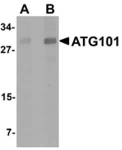 Western blot analysis of human liver tissue lysate at (A) 1 and (B) 2 ug/mL using ATG101 antibody 