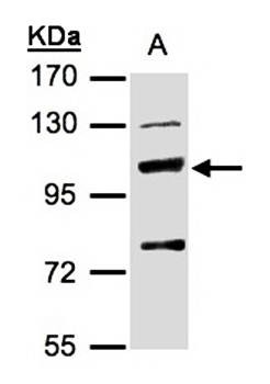 Western Blot analysis of A:HepG2 whole cell lysate using MANBA antibody