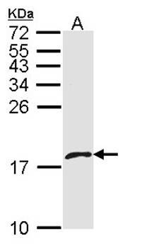 Western Blot analysis of A:A431 whole cell lysate using platelet factor 4 variant 1 antibody 
