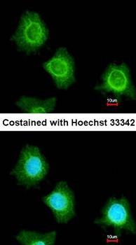  Confocal immunofluorescence analysis of methanol-fixed HeLa using platelet factor 4 variant 1 antibody