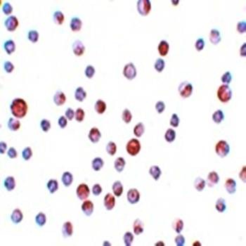 Immunohistochemical analysis of formalin-fixed and paraffin-embedded HeLa cells at 4 ug/mL using CaBP7 antibody