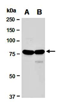 Western blot analysis of total cell extracts from human Jurkat(Lane1) and mouse thymus(Lane2) using TOX antibody