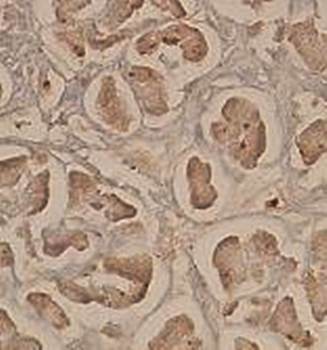  Immunohistochemical analysis of formalin-fixed paraffin embedded fetal testis showing cytoplasmic staining using AKR7A3 antibody