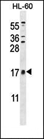  Western blot analysis of CNIH2 antibody in HL-60 cell line lysates 