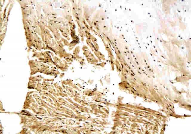  IHC-P of sheep thoracic using Collagen X antibody. 