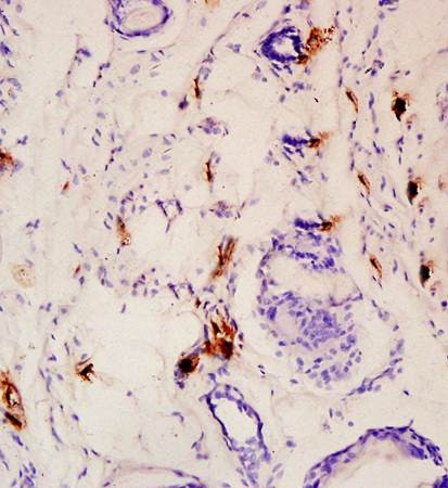  Immunohistochemical analysis of formalin fixed and paraffin embedded rat skin tissue using Collagen X antibody