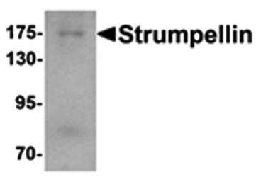 Western blot analysis of human ovary tissue lysate at 1 ug/mL using Strumpellin antibody