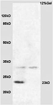 Western blot analysis of sheep non-fat milk 30ug(Lane1) and bovine non-fat milk 30ug(Lane2) using beta Casein antibody