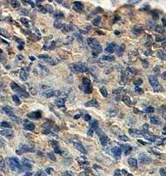  Immunohistochemical analysis of formalin-fixed paraffin embedded fetal spleen showing membrane staining using INPP5A antibody