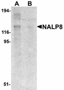 Western blot analysis of human colon tissue lysate at 1 ug/mL in (A) the absence and (B) the presence of blocking peptide using NALP8 antibody