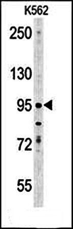  Western blot analysis of ENAM antibody in K562 cell line lysates 
