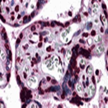 Immunohistochemical analysis of formalin-fixed and paraffin-embedded human placenta tissue at 5 ug/mL using KPNA7 antibody