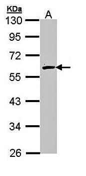 Western blot analysis of whole cell lysate using FMO2 antibody 