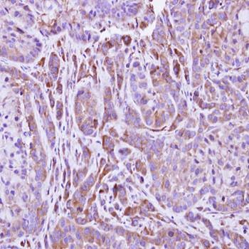  Immunohistochemical analysis of formalin-fixed and paraffin-embedded A549 xenograft using FMO2 antibody