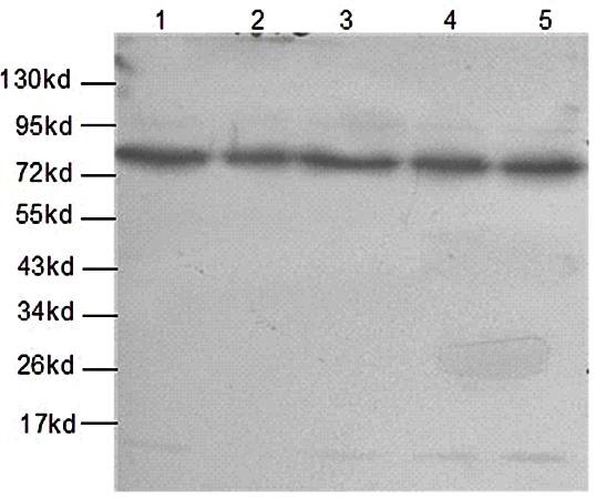 Western blot analysis of Hela(Lane1),Y79(Lane2),K562(Lane3),Ramos(Lane4),Jurkat(Lane5) in whole lysates using WBP11 antibody