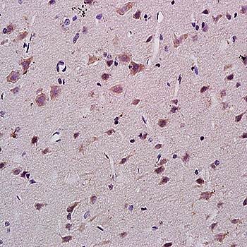 Immunohistochemical analysis of formalin-fixed and paraffin embedded rat brain tissue (Dilution at:1:200) using PCGF1 antibody