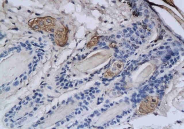 IHC-P of rat skin tissue using TPSB2 antibody.