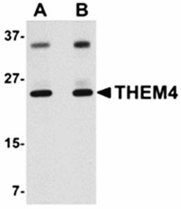 Western blot analysis of human liver tissue lysate at (A) 1 and (B) 2 ug/mL using THEM4 antibody 