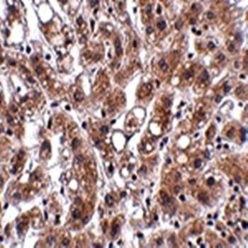  Immunohistochemical analysis of formalin-fixed and paraffin-embedded human liver tissue at 2.5 ug/mL using THEM4 antibody