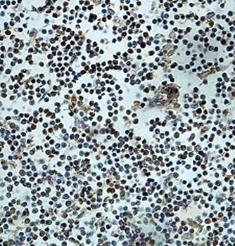 Immunohistochemical analysis of formalin-fixed paraffin embedded fetal lymphoid showing nuclear staining using ZNF22 antibody 