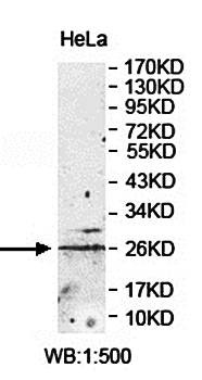  Western blot analysis of Hela cell lysate using ZNF22 antibody