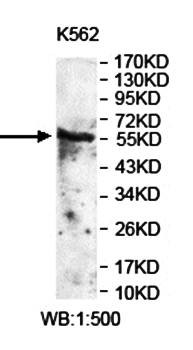 Western blot analysis of K562 cell lysate using ZNF238 antibody