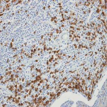 Immunohistochemical analysis of formalin-fixed and paraffin-embedded SCC xenograft using MTMR9 antibody