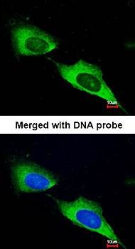 Confocal immunofluorescence analysis of paraformaldehyde-fixed HeLa using MTMR9 antibody