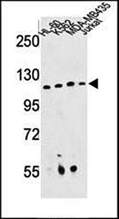  Western blot analysis of RPGRIP1 antibody in HL-60, K562, MDA-MB435, Jurkat cell line lysates
