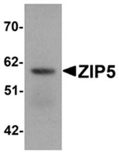 Western blot analysis of human spleen tissue lysate at 1 ug/mL using ZIP5 antibody 