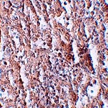  Immunohistochemical analysis of formalin-fixed and paraffin-embedded human spleen tissue at 2.5 ug/mL using ZIP5 antibody