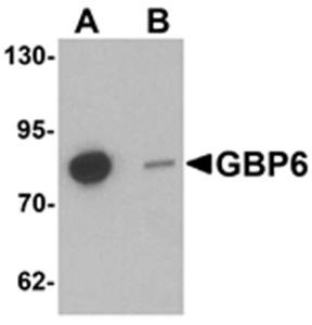 Western blot analysis of HeLa cell lysate at 0.5 ug/mL in (A) the absence and (B) the presence of blocking peptide using GBP6 antibody