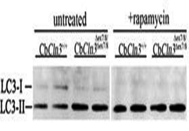  Western blot analysis of homozygous cerebellar cells using LC3 antibody 