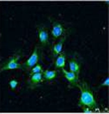  Immunohistrochemical analysis of formalin-fixed and paraffin-embedded human testis tissue using LC3 antibody 