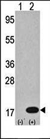  Western blot analysis of LC3 antibody in 293 cell line lysates 