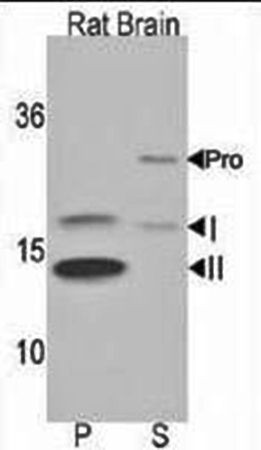  Western blot analysis of LC3 antibody in 293 cell line lysates