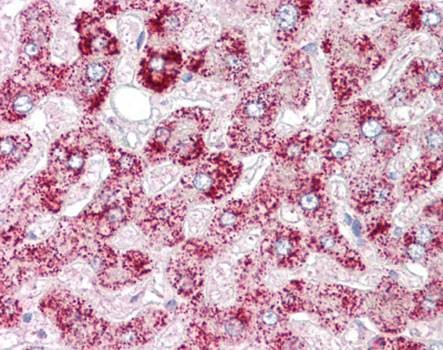 Immunohistochemical staining of paraffin embedded human liver tissue using ORMDL1 antibody (primary antibody at 1:200)