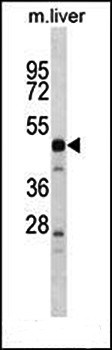 Western blot analysis of mouse liver tissue lysates (35ug/lane) using PRSS16 (N-term) antibody 
