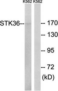 Western blot analysis of extracts from K562 cells using STK36 antibody 