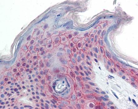 Immunohistochemical staining of paraffin embedded human skin tissue using PPPDE1 antibody (primary antibody at 1:200)