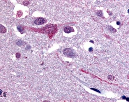 Immunohistochemical staining of paraffin embedded human brain tissue using SGLT4 antibody (primary antibody at 1:200)